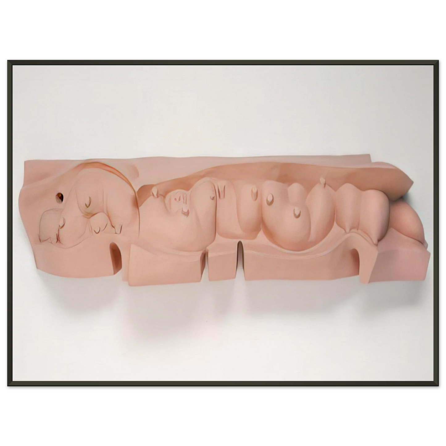 Louise Bourgeois MAMELLES 1991 Framed Art Print - Aluminum Frame - 40x50 cm / 16x20 inches