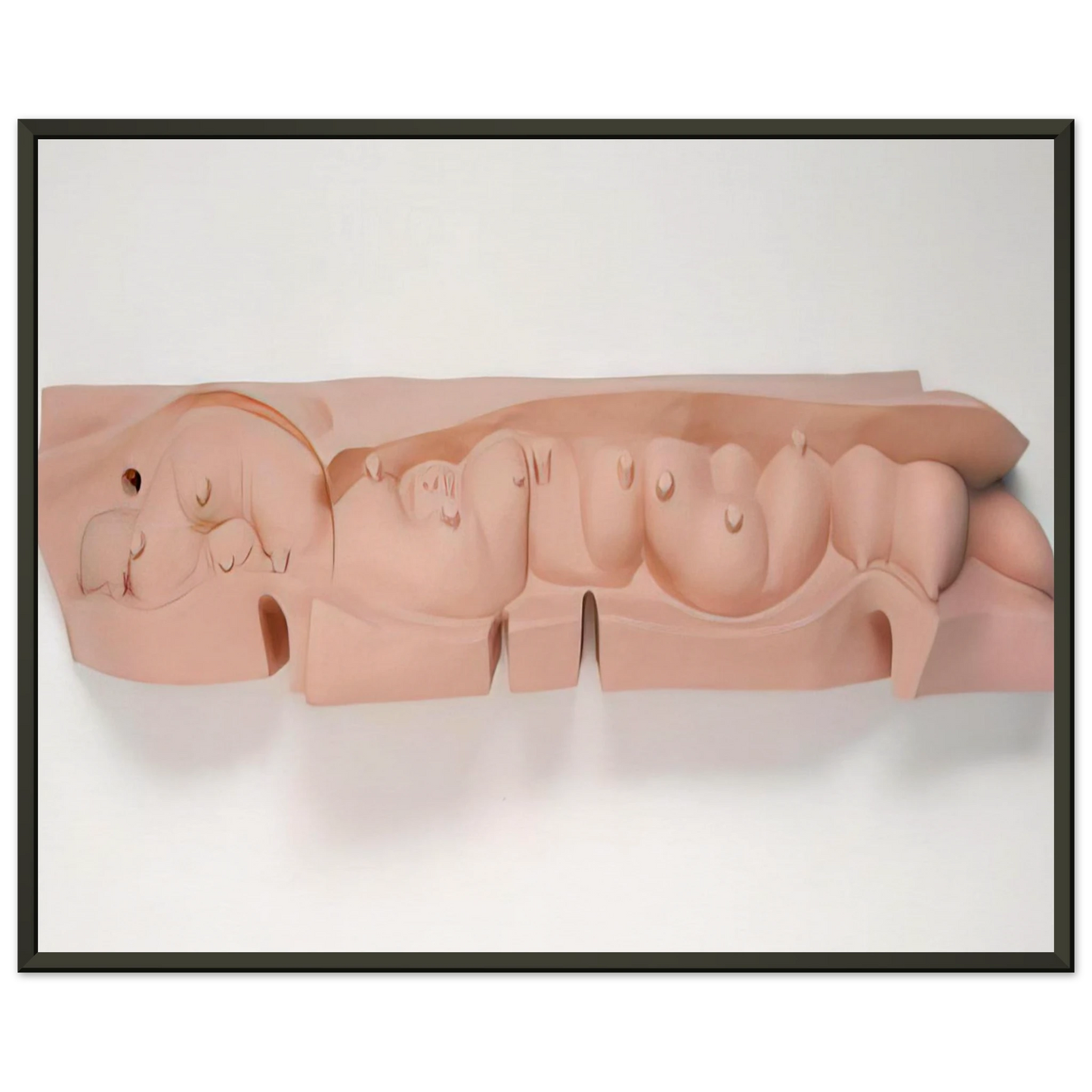 Louise Bourgeois MAMELLES 1991 Framed Art Print - Aluminum Frame - 70x100 cm / 28x40 inches