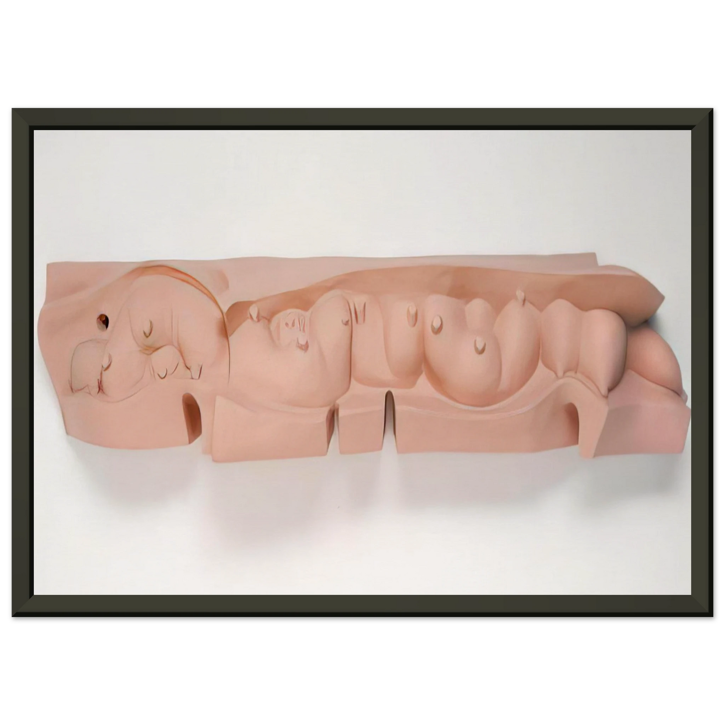 Louise Bourgeois MAMELLES 1991 Framed Art Print - Aluminum Frame - 60x80 cm / 24x32 inches